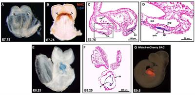 Endocardial-Myocardial Interactions During Early Cardiac Differentiation and Trabeculation